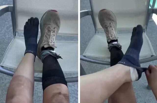 160 kilometre koşan sporcunun ayaklarının son hali inanılmaz