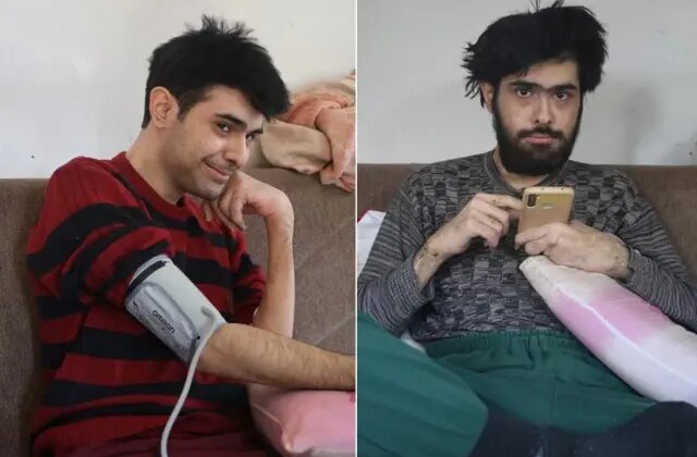 3 yıl sonra duş alıp tıraş olan Barış’a teşhis koyuldu