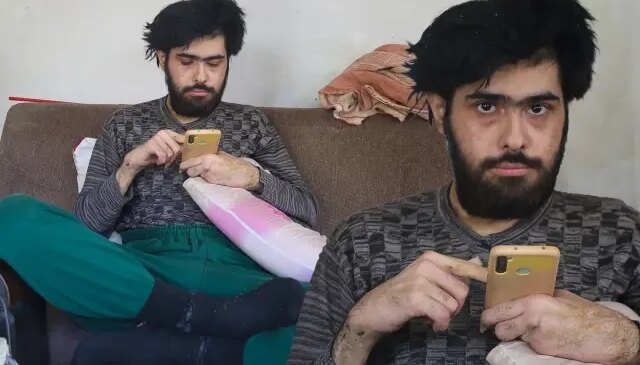 3 yıldır tırnaklarını kesmeyen ve duş almayan gencin eski hali ortaya çıktı