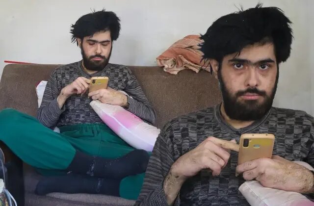 3 yıldır tırnaklarını kesmeyen ve duş almayan gencin eski hali ortaya çıktı