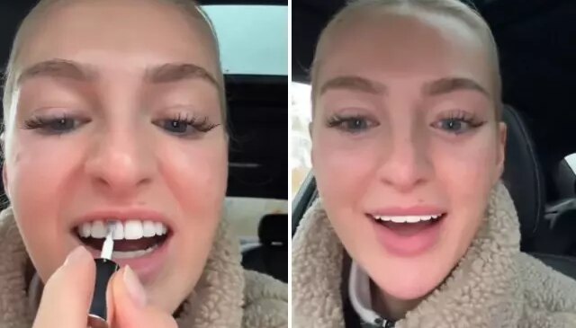 Dişlerini beyazlatmak için yaptığı akılalmaz!