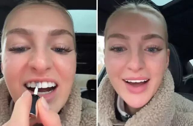 Dişlerini beyazlatmak için yaptığı akılalmaz!