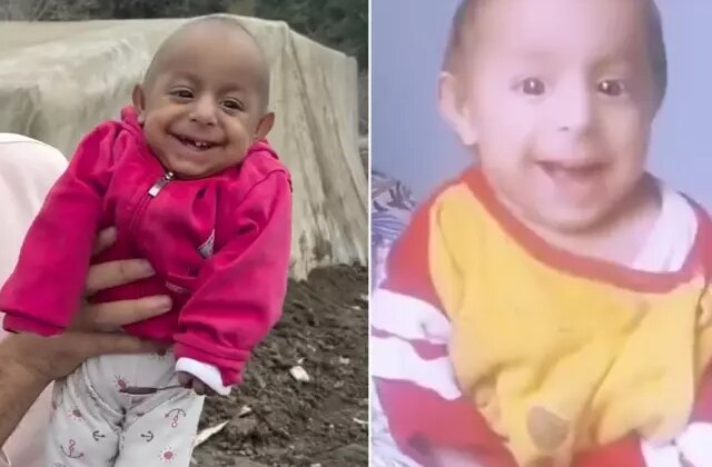 “Gülen Bebek” olarak tanınan Ökkeş Bebek hayatını kaybetti