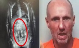 Hapishane girişinde fark edildi! X-Ray’de ortaya çıkan gerçek polislerin ağzını açık bıraktı