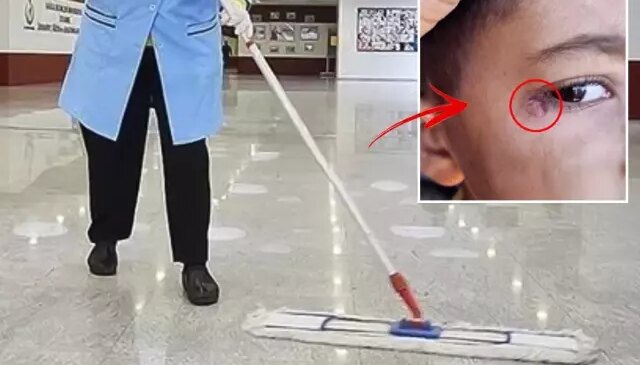 İlkokulda dehşet! Temizlik görevlisi minik Mustafa’nın yüzünde sigara söndürdü