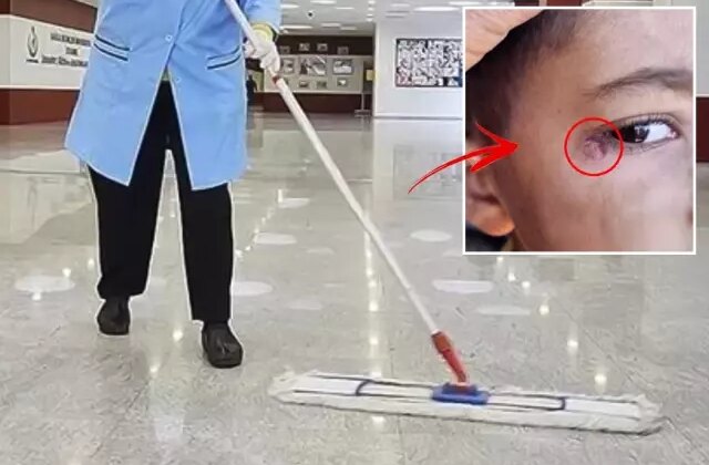 İlkokulda dehşet! Temizlik görevlisi minik Mustafa’nın yüzünde sigara söndürdü
