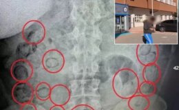 Midesinden çıkanlar yok artık dedirtti