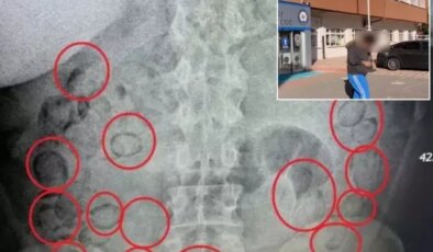 Midesinden çıkanlar yok artık dedirtti