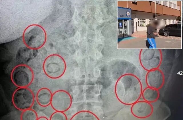 Midesinden çıkanlar yok artık dedirtti