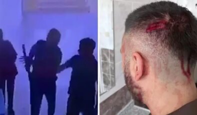 Öğretmene veliden sopalı saldırı