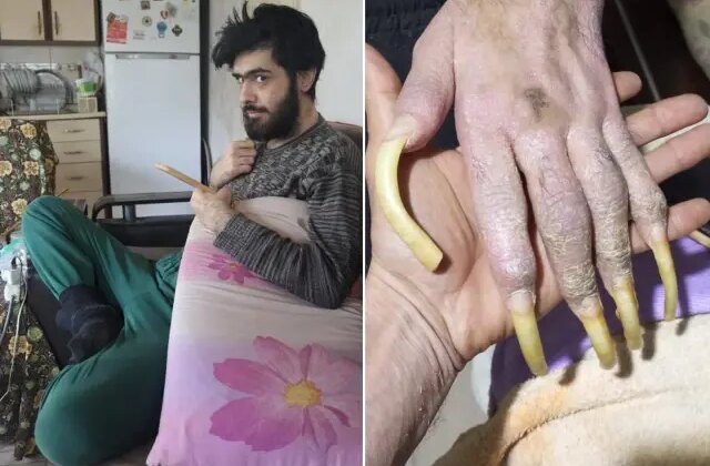 Telefon bağımlısı genç: Elimde olsa tuvalete de gitmem, yemek de yemem