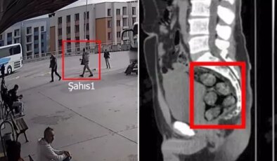 Tomografideki görüntü şoke etti! Zehir tacirleri yakayı böyle ele verdi