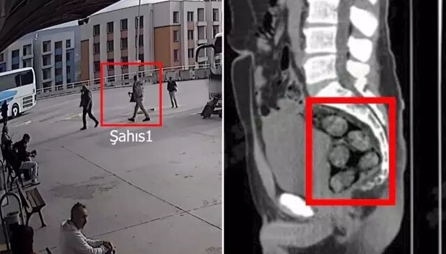 Tomografideki görüntü şoke etti! Zehir tacirleri yakayı böyle ele verdi