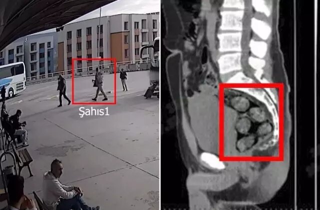 Tomografideki görüntü şoke etti! Zehir tacirleri yakayı böyle ele verdi