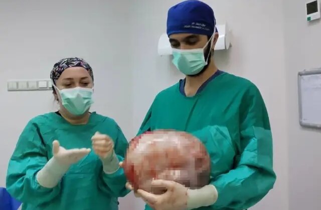 2 ayda 9 aylık hamile gibi büyüdü, doktorlar görünce apar topar ameliyata aldı