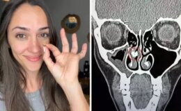 35 yıl sonra ortaya çıkan gerçek: Burnundan çıkan şeye kimse inanamadı