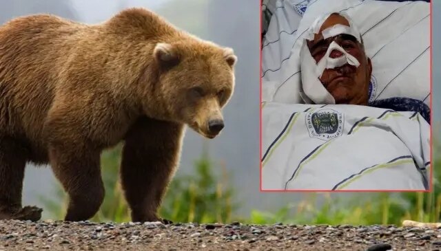 Neye uğradığını şaşırdı! Pençe darbeleri aldı, elmacık kemiği koptu