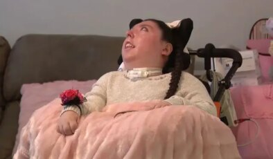 Beyinsiz doğan Alex 20 yaşında, doktorlar 5 yıl yaşamaz demişti