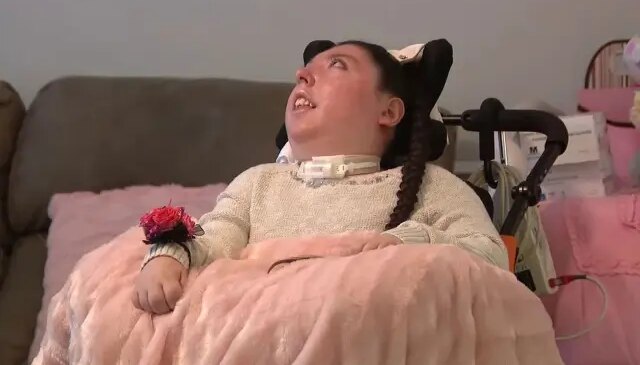 Beyinsiz doğan Alex 20 yaşında, doktorlar 5 yıl yaşamaz demişti