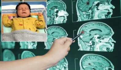 Çığır açacak adım! Beyin hasarı artık erken tespit edilebilecek