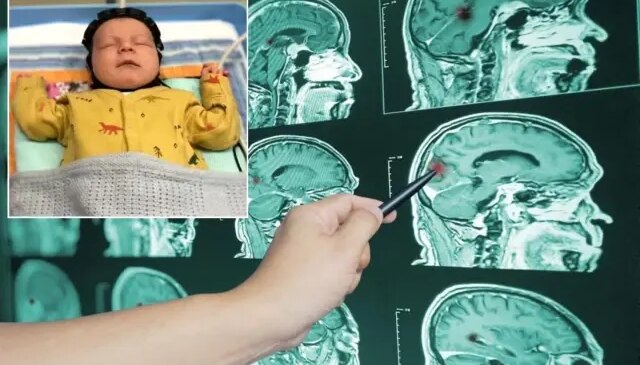 Çığır açacak adım! Beyin hasarı artık erken tespit edilebilecek