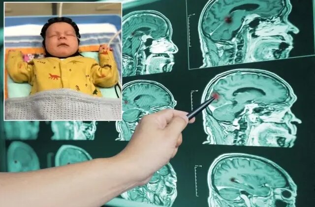 Çığır açacak adım! Beyin hasarı artık erken tespit edilebilecek