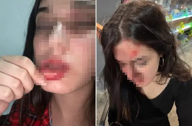 Eski sevgili dehşeti! “Beni tuzağa düşürdü” deyip fotoğraflarını paylaştı