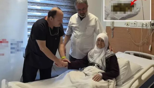 Yaşlı kadının safra kesesinden 213 adet taş çıktı