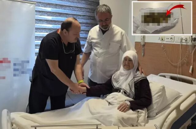 Yaşlı kadının safra kesesinden 213 adet taş çıktı