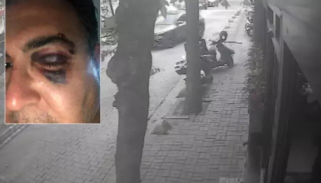 İstanbul’un göbeğinde iş insanına dayak! O anlar kamerada