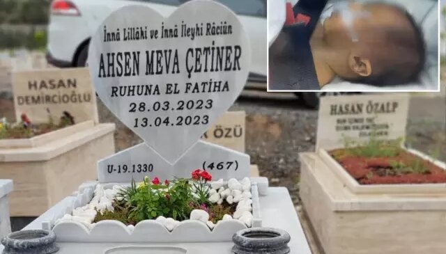 Özel hastanede skandal! Ahsen Bebek’in kafatasında kırık tespit edildi