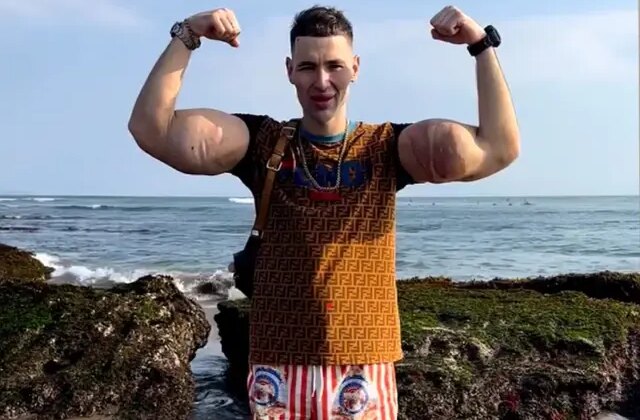 Rus Temel Reis’in kolları tehlikede: Tehlikeli enjeksiyonlar ağır enfeksiyona yol açtı