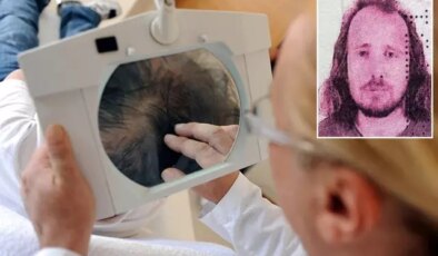 Saç ektirip diş yaptıran İngiliz aniden fenalaşarak hayatını kaybetti