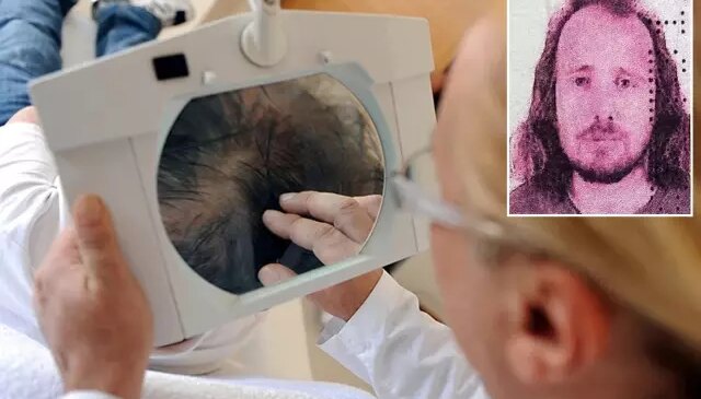 Saç ektirip diş yaptıran İngiliz aniden fenalaşarak hayatını kaybetti