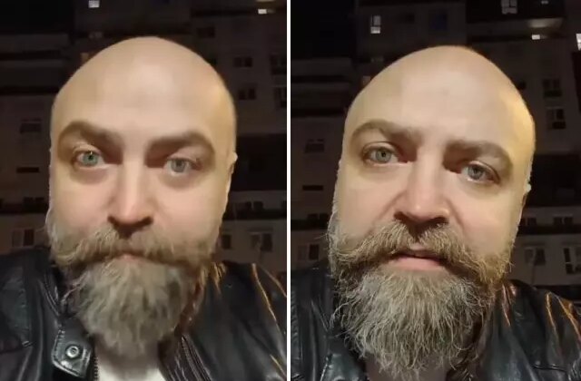 Saçsız adam isyan etti! Berbere ödediği ücret öyle böyle değil