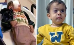 Torpil küçük çocuğun gözünü kör etti, babası kahreden gerçeği açıkladı