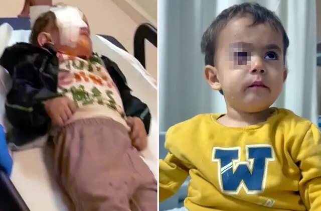 Torpil küçük çocuğun gözünü kör etti, babası kahreden gerçeği açıkladı