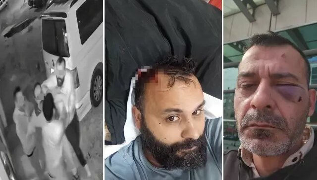 Ünlü fenomene eşi ve ailesinden öldüresiye dayak