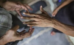 44 yıl sonra bir ilk! 2 ülkede cüzzam vakaları görülmeye başladı