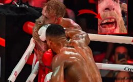 6. rauntta kabusu yaşamıştı! İşte çenesi kırılan Jake Paul’un son hali