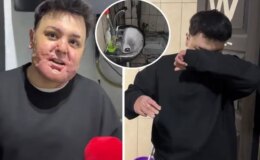 65 ameliyat geçirdi, 12 gün uyutuldu! Hayatı saniyeler içinde kabusa döndü