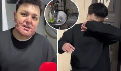 65 ameliyat geçirdi, 12 gün uyutuldu! Hayatı saniyeler içinde kabusa döndü