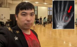 Akılalmaz hata! Eline yerleştirdiği mikroçipin şifresini unuttu