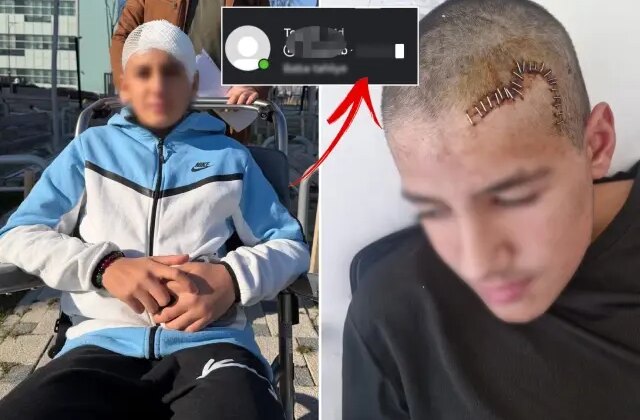 Okul arkadaşı taşla kafasını parçaladı! Tahliye edilen çocuğun paylaşımı çıldırttı