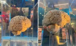 Amsterdam’daki dev arşiv: 5 bin 300 beyin yapay zeka ile haritalanacak