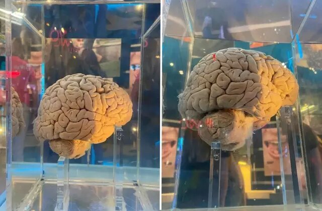 Amsterdam’daki dev arşiv: 5 bin 300 beyin yapay zeka ile haritalanacak