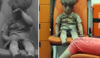 Bakın nerede ortaya çıktı: İşte dünya gündemine oturan Ümran bebeğin son hali