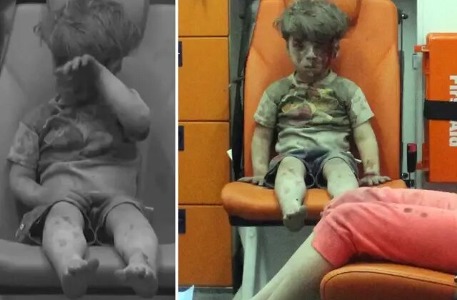 Bakın nerede ortaya çıktı: İşte dünya gündemine oturan Ümran bebeğin son hali