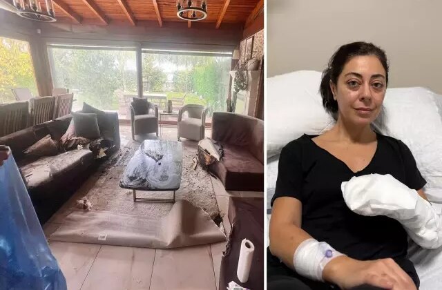 Sakın evinize sokmayın! Dekoratif olarak aldı, vücudunun yüzde 30’u yandı