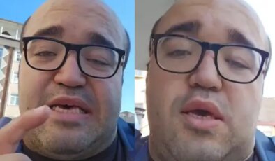 Diş tedavisi fiyatları araba fiyatını geçti!